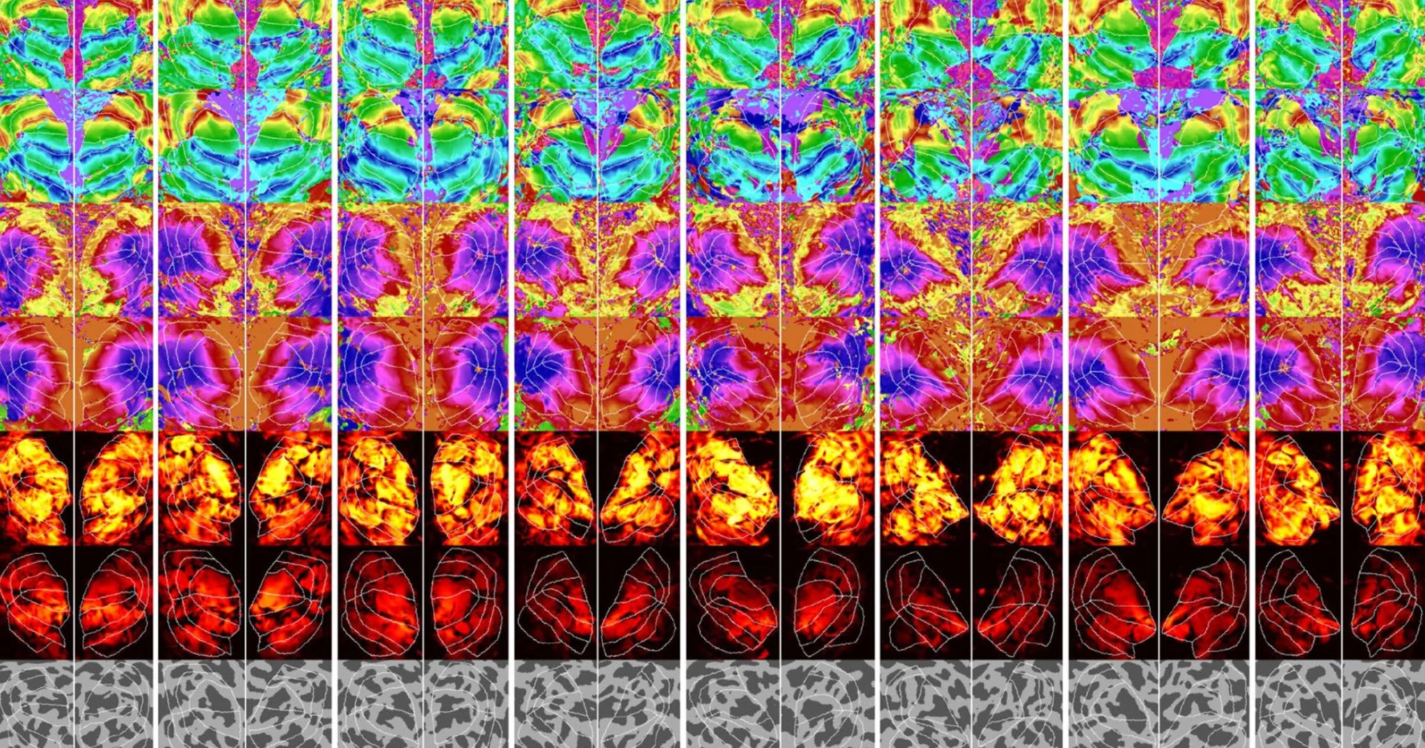 Researchers Develop AI Tool to Interpret Thoughts from Brain Scans